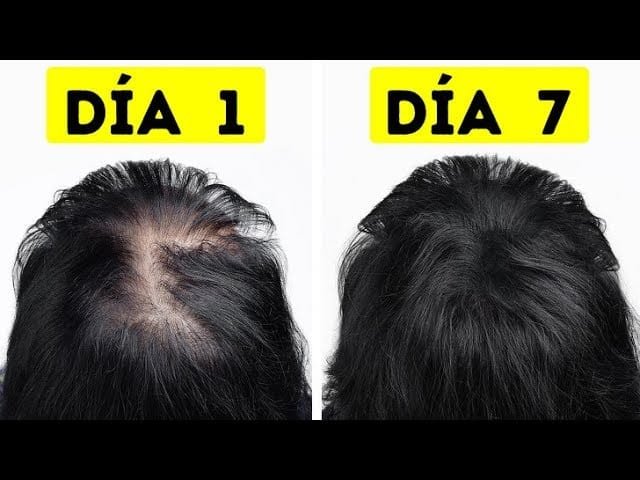 Como Hacer El Cabello Mas Grueso Hombres