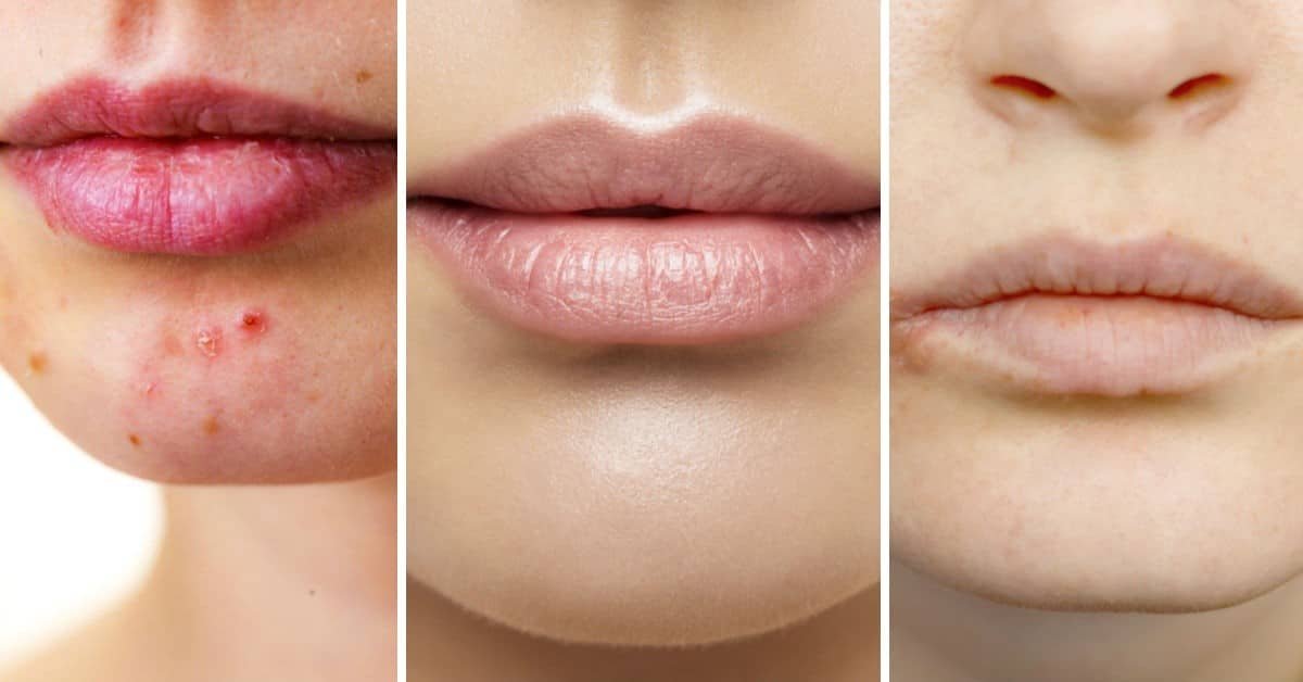 Como Recuperar El Color De Los Labios