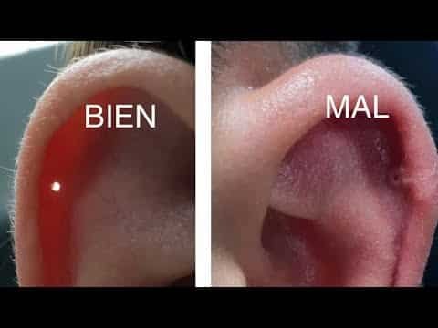 Como Tratar Un Piercing Infectado