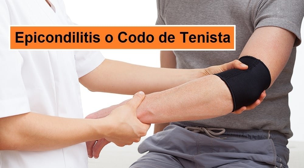 ¡Cura tu Epicondilitis ahora! El Codo del Tenista