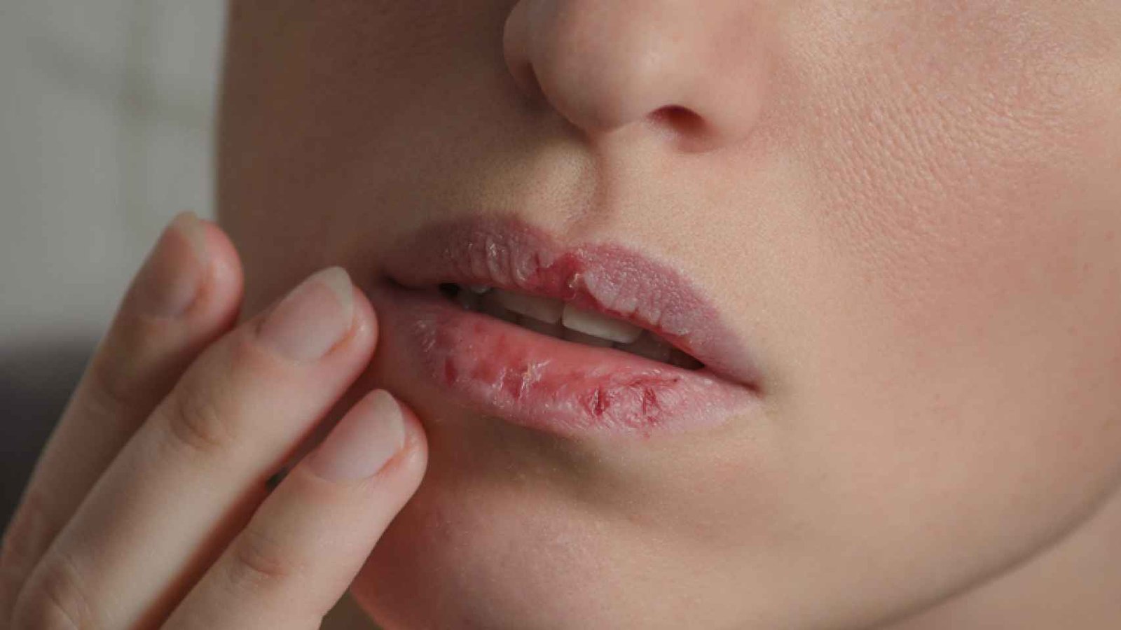 Labios agrietados: ¿Qué aplicar para una hidratación efectiva?